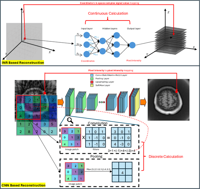 Figure 1 for Accelerated Patient-specific Non-Cartesian MRI Reconstruction using Implicit Neural Representations