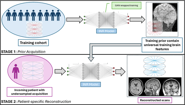 Figure 3 for Accelerated Patient-specific Non-Cartesian MRI Reconstruction using Implicit Neural Representations