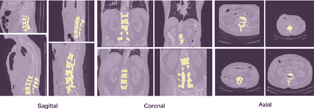 Figure 3 for DoubleU-Net++: Architecture with Exploit Multiscale Features for Vertebrae Segmentation