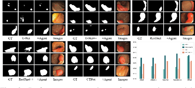 Figure 3 for AgentPolyp: Accurate Polyp Segmentation via Image Enhancement Agent
