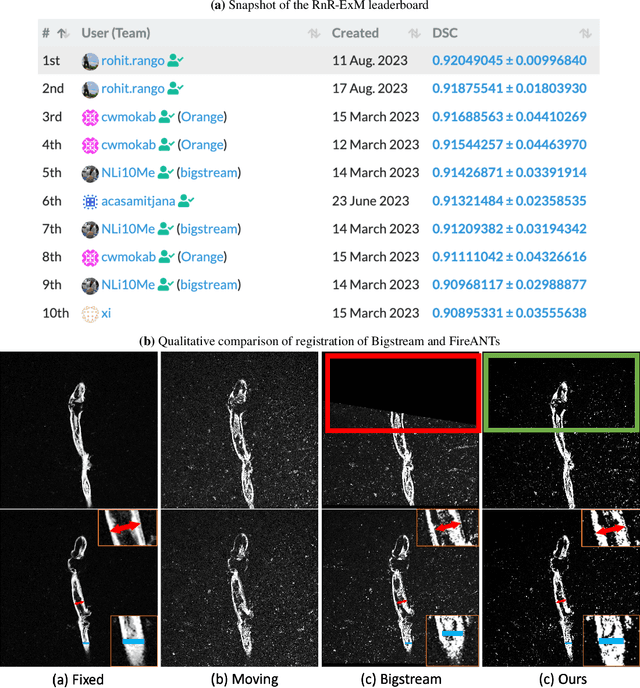 Figure 4 for FireANTs: Adaptive Riemannian Optimization for Multi-Scale Diffeomorphic Registration
