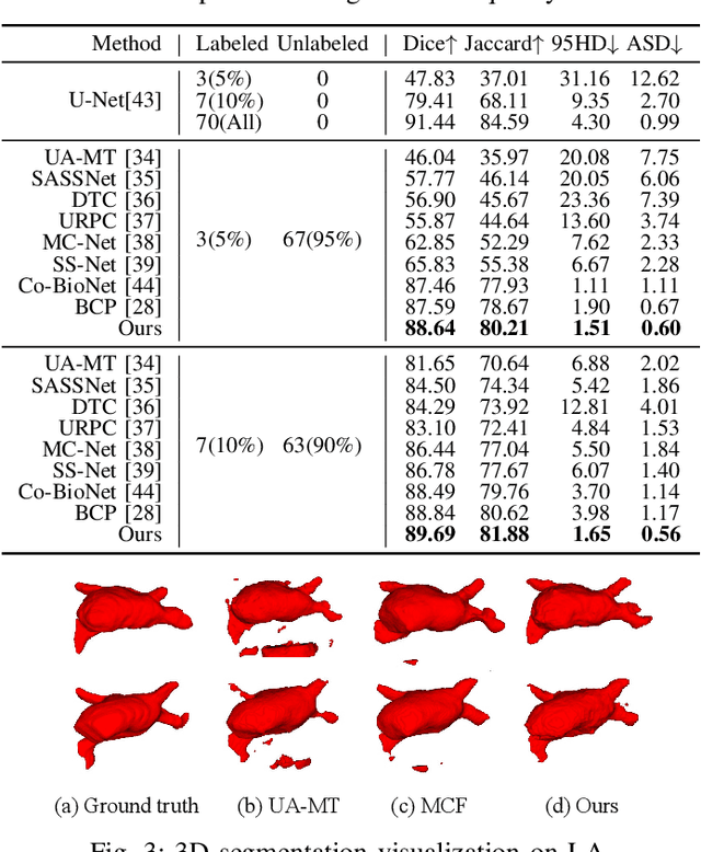 Figure 3 for Multi-Prototype Embedding Refinement for Semi-Supervised Medical Image Segmentation