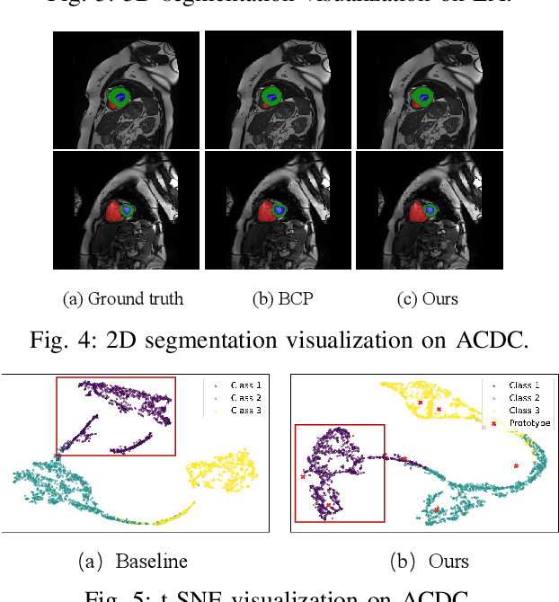 Figure 4 for Multi-Prototype Embedding Refinement for Semi-Supervised Medical Image Segmentation