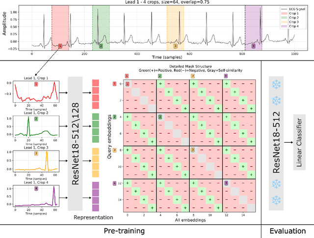 Figure 1 for Learning ECG Representations via Poly-Window Contrastive Learning