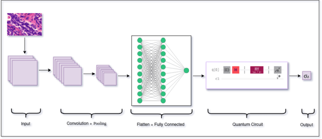 Figure 1 for An ensemble framework approach of hybrid Quantum convolutional neural networks for classification of breast cancer images
