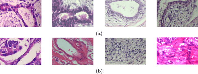 Figure 4 for An ensemble framework approach of hybrid Quantum convolutional neural networks for classification of breast cancer images
