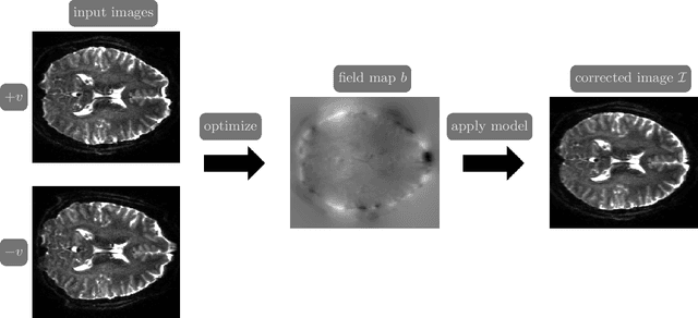 Figure 1 for PyHySCO: GPU-Enabled Susceptibility Artifact Distortion Correction in Seconds