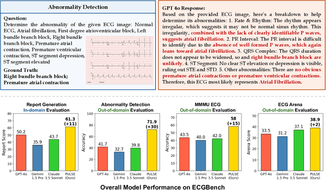 Figure 1 for Teach Multimodal LLMs to Comprehend Electrocardiographic Images