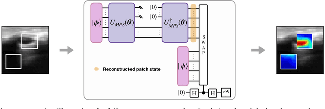 Figure 2 for Quantum Patch-Based Autoencoder for Anomaly Segmentation