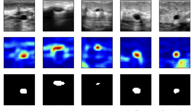 Figure 4 for Quantum Patch-Based Autoencoder for Anomaly Segmentation