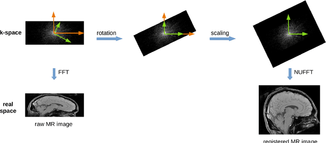 Figure 1 for Improving the Test-retest Reliability of Quantitative Susceptibility Mapping