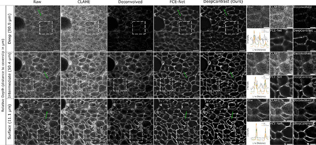 Figure 3 for DeepContrast: Deep Tissue Contrast Enhancement using Synthetic Data Degradations and OOD Model Predictions