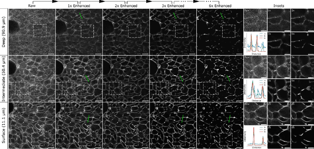 Figure 4 for DeepContrast: Deep Tissue Contrast Enhancement using Synthetic Data Degradations and OOD Model Predictions