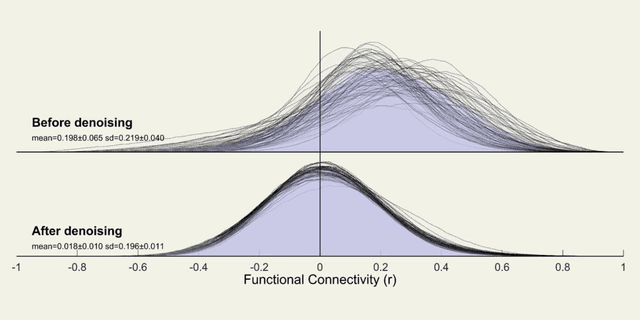 Figure 3 for A Network Theory Investigation into the Altered Resting State Functional Connectivity in Attention-Deficit Hyperactivity Disorder