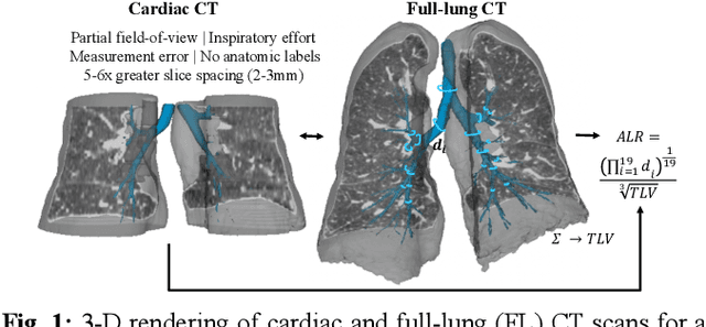 Figure 1 for Multi-View Transformers for Airway-To-Lung Ratio Inference on Cardiac CT Scans: The C4R Study