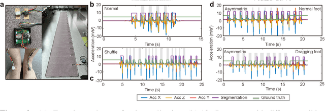 Figure 3 for GaitMotion: A Multitask Dataset for Pathological Gait Forecasting