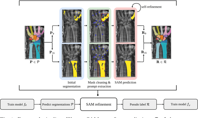Figure 1 for SAM Carries the Burden: A Semi-Supervised Approach Refining Pseudo Labels for Medical Segmentation