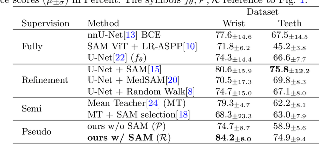 Figure 2 for SAM Carries the Burden: A Semi-Supervised Approach Refining Pseudo Labels for Medical Segmentation