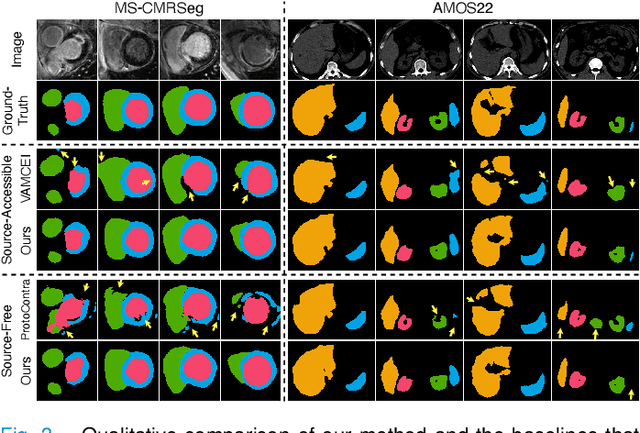 Figure 3 for Unified and Semantically Grounded Domain Adaptation for Medical Image Segmentation