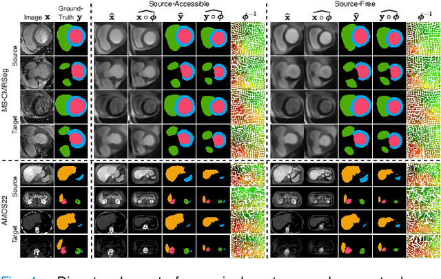 Figure 4 for Unified and Semantically Grounded Domain Adaptation for Medical Image Segmentation