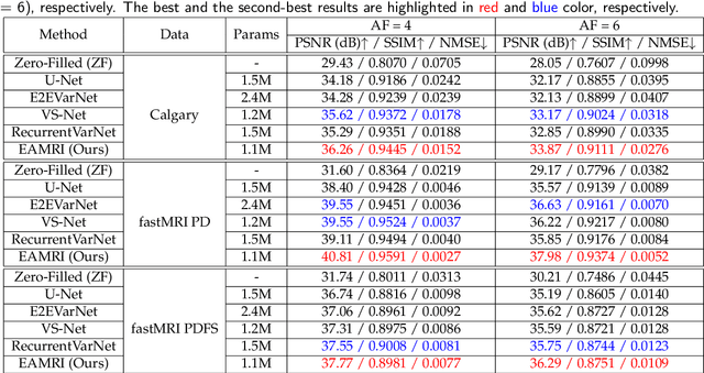 Figure 4 for Fast MRI Reconstruction via Edge Attention