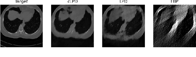 Figure 2 for Continuous Learned Primal Dual