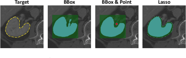 Figure 4 for nnInteractive: Redefining 3D Promptable Segmentation