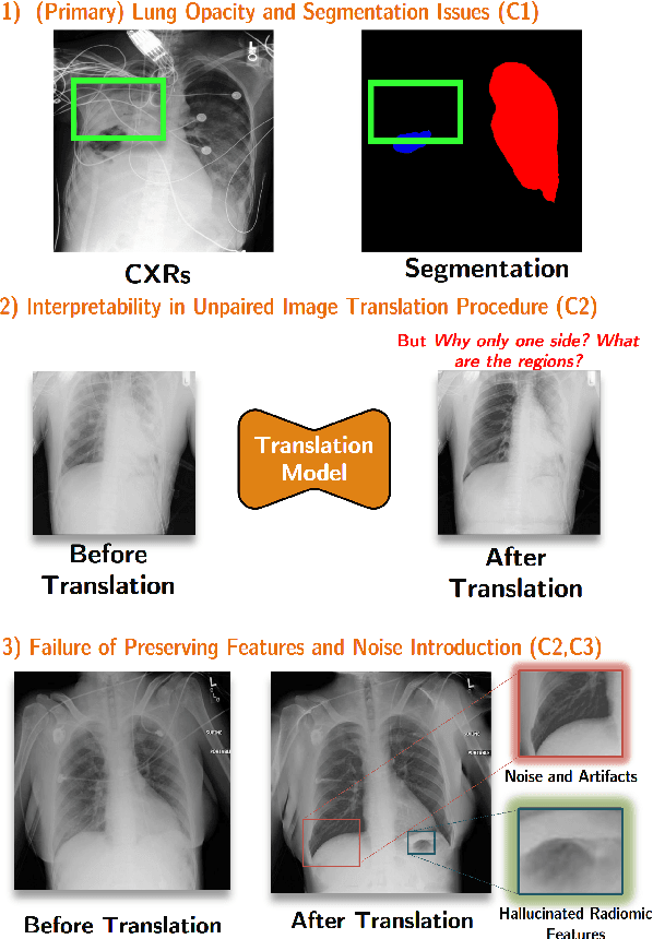 Figure 1 for Unpaired Translation of Chest X-ray Images for Lung Opacity Diagnosis via Adaptive Activation Masks and Cross-Domain Alignment