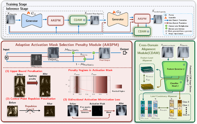 Figure 3 for Unpaired Translation of Chest X-ray Images for Lung Opacity Diagnosis via Adaptive Activation Masks and Cross-Domain Alignment