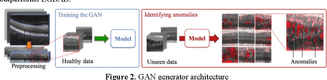 Figure 2 for Utilizing GANs for Fraud Detection: Model Training with Synthetic Transaction Data