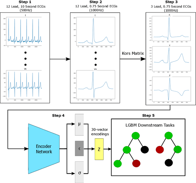 Figure 1 for Comparison of Autoencoder Encodings for ECG Representation in Downstream Prediction Tasks