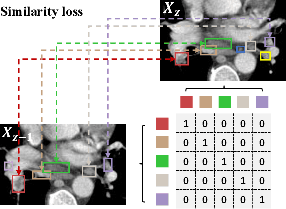 Figure 3 for From Slices to Sequences: Autoregressive Tracking Transformer for Cohesive and Consistent 3D Lymph Node Detection in CT Scans