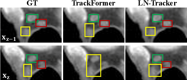 Figure 4 for From Slices to Sequences: Autoregressive Tracking Transformer for Cohesive and Consistent 3D Lymph Node Detection in CT Scans