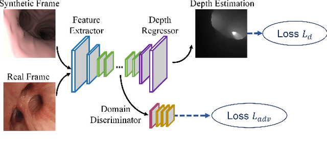 Figure 1 for Enhancing Bronchoscopy Depth Estimation through Synthetic-to-Real Domain Adaptation