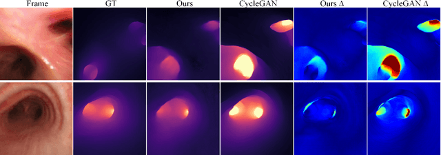 Figure 2 for Enhancing Bronchoscopy Depth Estimation through Synthetic-to-Real Domain Adaptation
