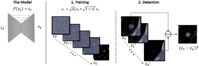 Figure 1 for Back-in-Time Diffusion: Unsupervised Detection of Medical Deepfakes