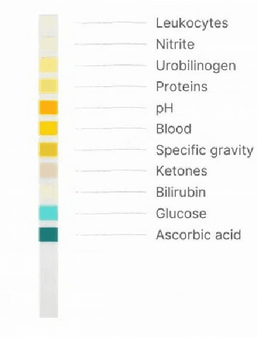 Figure 1 for An Ensemble Machine Learning Approach for Screening Covid-19 based on Urine Parameters