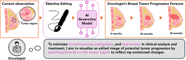 Figure 1 for Interactive Tumor Progression Modeling via Sketch-Based Image Editing