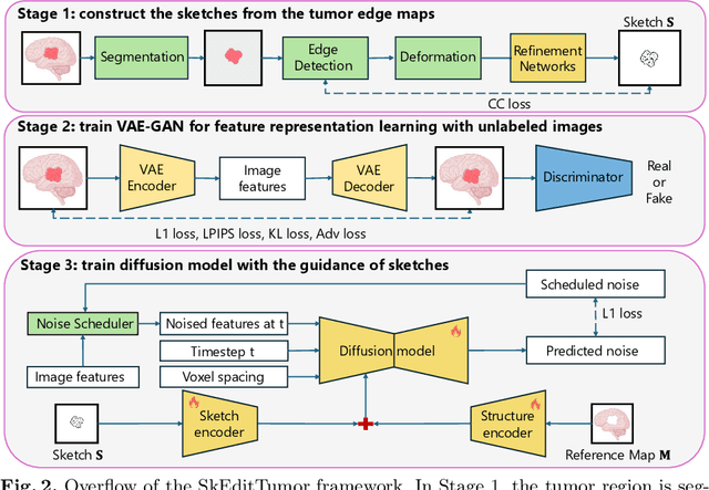 Figure 3 for Interactive Tumor Progression Modeling via Sketch-Based Image Editing