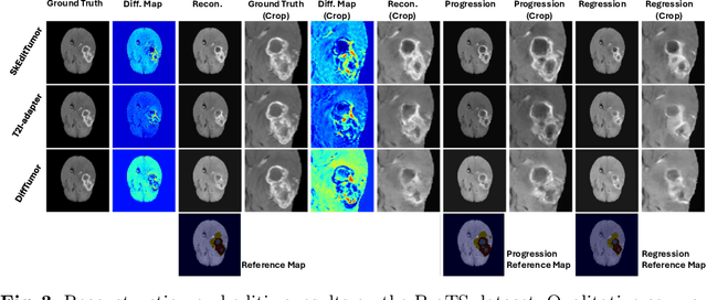 Figure 4 for Interactive Tumor Progression Modeling via Sketch-Based Image Editing