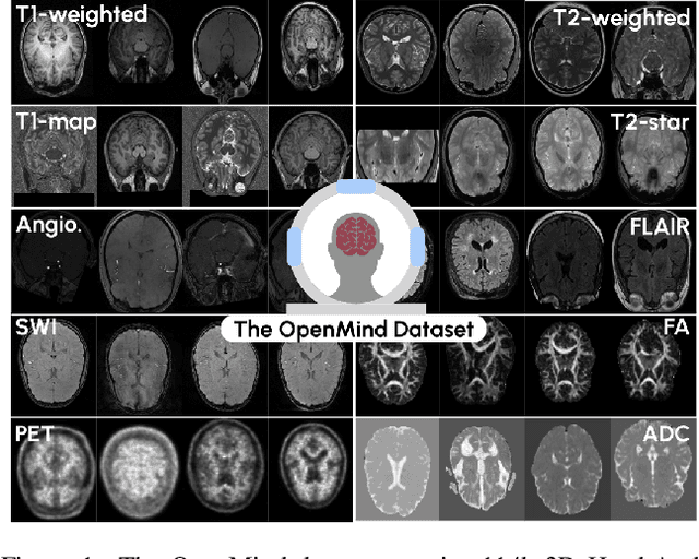 Figure 2 for An OpenMind for 3D medical vision self-supervised learning