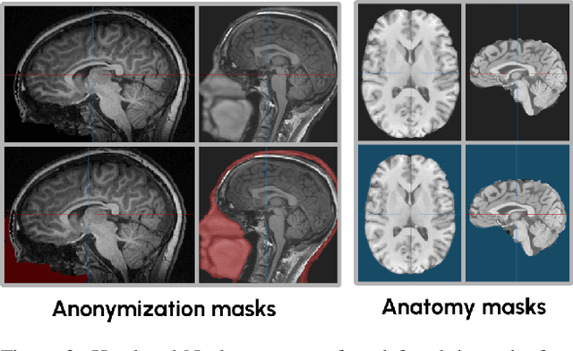 Figure 3 for An OpenMind for 3D medical vision self-supervised learning