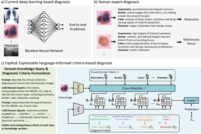 Figure 1 for Aligning Human Knowledge with Visual Concepts Towards Explainable Medical Image Classification