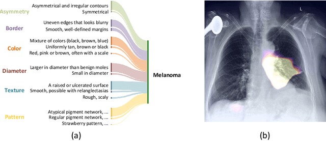 Figure 3 for Aligning Human Knowledge with Visual Concepts Towards Explainable Medical Image Classification