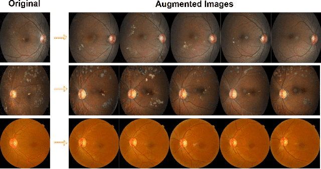 Figure 3 for Divergent Domains, Convergent Grading: Enhancing Generalization in Diabetic Retinopathy Grading