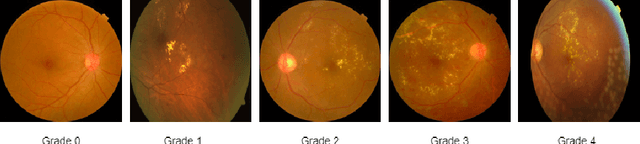 Figure 3 for DGM-DR: Domain Generalization with Mutual Information Regularized Diabetic Retinopathy Classification