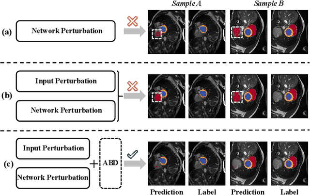 Figure 1 for Adaptive Bidirectional Displacement for Semi-Supervised Medical Image Segmentation