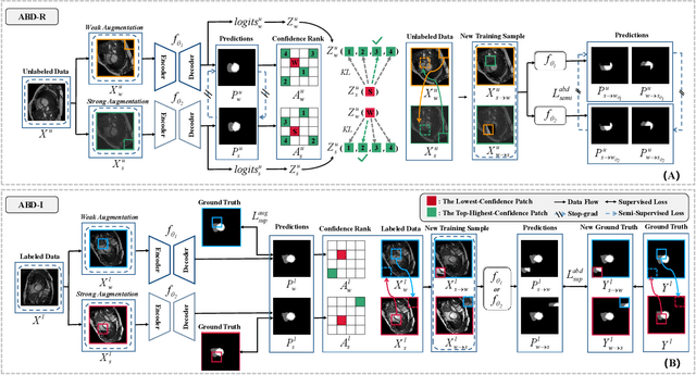 Figure 3 for Adaptive Bidirectional Displacement for Semi-Supervised Medical Image Segmentation
