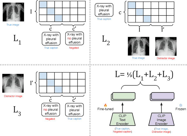 Figure 3 for The Effect of Negation on CLIP in Medical Imaging: Limitations of Contrastive Language-Image Pretraining