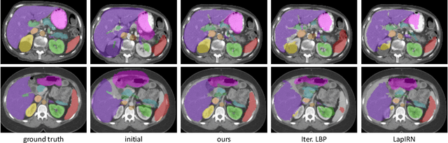 Figure 4 for Unsupervised 3D registration through optimization-guided cyclical self-training